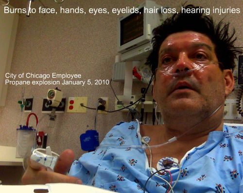 City of Chicago Employee victim of Propane Explosion